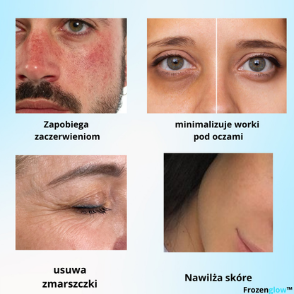 Miska z lodem do twarzy  + E-BOOK Gratis — naturalna krioterapia🧊