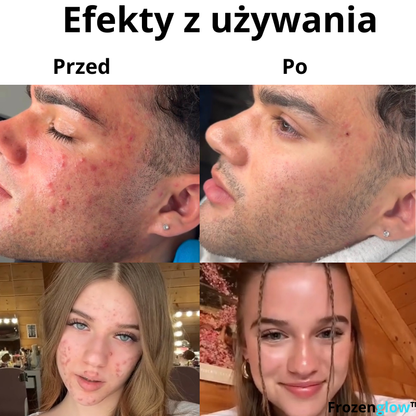 Miska z lodem do twarzy  + E-BOOK Gratis — naturalna krioterapia🧊